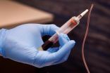 الصحة : أكثر من 100 مصاب بكورونا استفادوا من العلاج ببلازما الدم