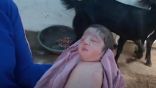 ولادة طفلة في الهند بدون أطراف